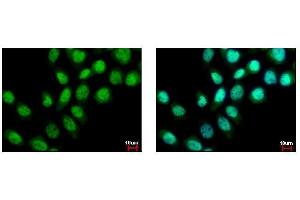 ICC/IF Image BS69 antibody detects ZMYND11 protein at nucleus by immunofluorescent analysis.