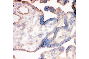 IHC analysis of Integrin alpha 4 using anti-Integrin alpha 4 antibody (ABIN3043255). (ITGA4 antibody  (C-Term))
