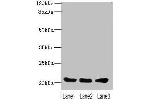Western blot All lanes: PLLP antibody at 4 μg/mL Lane 1: Mouse gonadal tissue Lane 2: Mouse kidney tissue Lane 3: Mouse lung tissue Secondary Goat polyclonal to rabbit IgG at 1/10000 dilution Predicted band size: 20 kDa Observed band size: 20 kDa (Plasmolipin antibody  (AA 1-35))