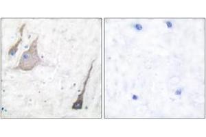 Immunohistochemistry analysis of paraffin-embedded human brain tissue, using Synuclein-pan Antibody. (Synuclein antibody  (AA 15-64))
