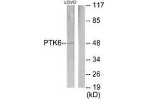 Western blot analysis of extracts from LOVO cells, using Breast Tumor Kinase Antibody. (PTK6 antibody  (AA 10-59))