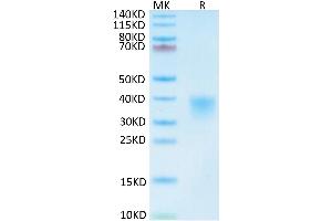 Mouse CD8 alpha on Tris-Bis PAGE under reduced condition. (CD8 alpha Protein (AA 28-196) (His tag))