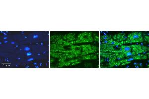 Rabbit Anti-OPTN Antibody   Formalin Fixed Paraffin Embedded Tissue: Human heart Tissue Observed Staining: Cytoplasmic Primary Antibody Concentration: N/A Other Working Concentrations: 1:600 Secondary Antibody: Donkey anti-Rabbit-Cy3 Secondary Antibody Concentration: 1:200 Magnification: 20X Exposure Time: 0. (OPTN antibody  (N-Term))