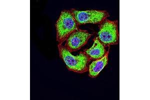 Immunofluorescence analysis of Hela cells using CD46 mouse mAb (green). (CD46 antibody  (AA 35-179))