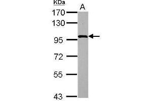 Western Blotting (WB) image for anti-Catenin (Cadherin-Associated Protein), beta 1, 88kDa (CTNNB1) (N-Term) antibody (ABIN2855042)