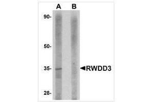 Western blot analysis of RWDD3 in rat kidney tissue lysate with RWDD3 antibody at 1 μg/ml in (A) the absence and (B) the presence of blocking peptide. (RWDD3 antibody  (C-Term))