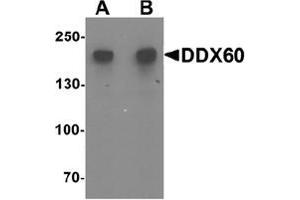 Western blot analysis of DDX60 in A20 cell lysate with DDX60 Antibody  at (A) 1 and (B) 2 ug/mL. (DDX60 antibody  (Middle Region))