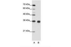 Image no. 2 for anti-Wingless-Type MMTV Integration Site Family, Member 2B (WNT2B) (AA 229-278) antibody (ABIN203089) (WNT2B antibody  (AA 229-278))