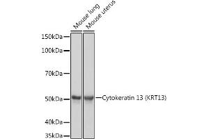 Western blot analysis of extracts of various cell lines, using Cytokeratin 13 (KRT13) (KRT13) Rabbit mAb (ABIN7268089) at 1:1000 dilution. (Cytokeratin 13 antibody)