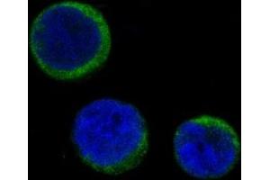 Immunofluorescent analysis of Jurkat cells, using Ferritin Antibody. (Recombinant Ferritin antibody)