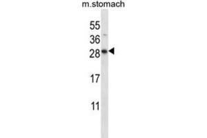 Western Blotting (WB) image for anti-Dolichyl Pyrophosphate Phosphatase 1 (DOLPP1) antibody (ABIN2997455)