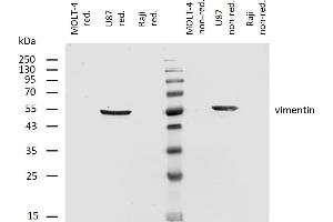 Western blotting analysis of human vimentin using mouse monoclonal antibody VI-RE/1 on lysates of MOLT-4 cell line (low expression), U87 cell line (positive) and Raji cell line (negative control) under non-reducing and reducing conditions.