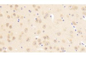 Detection of PCDHb2 in Mouse Cerebrum Tissue using Polyclonal Antibody to Protocadherin Beta 2 (PCDHb2) (PCDHb2 antibody  (AA 79-253))