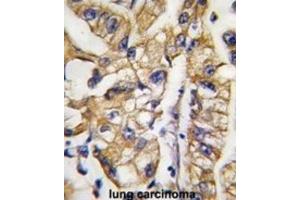 Immunohistochemistry (IHC) image for anti-SLC2A4 Regulator (SLC2A4RG) antibody (ABIN2997830) (SLC2A4RG antibody)