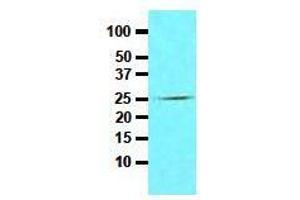 Western Blotting (WB) image for anti-Fas (TNFRSF6)-Associated Via Death Domain (FADD) (AA 1-208), (N-Term) antibody (ABIN317514) (FADD antibody  (N-Term))