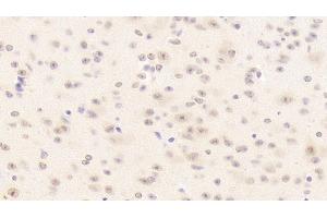 Detection of LRRC32 in Mouse Cerebellum Tissue using Polyclonal Antibody to Leucine Rich Repeat Containing Protein 32 (LRRC32) (LRRC32 antibody  (AA 400-643))