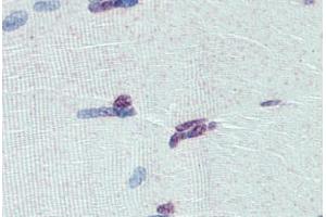 Human Skeletal Muscle: Formalin-Fixed, Paraffin-Embedded (FFPE) (PRDM9 antibody  (AA 431-480))