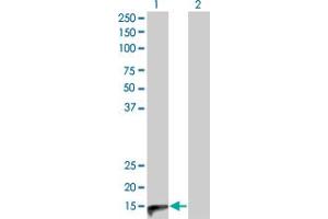 Western Blot analysis of CALCA expression in transfected 293T cell line by CALCA monoclonal antibody (M01), clone 4B10. (CGRP antibody  (AA 52-141))