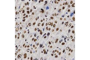 Immunohistochemistry (IHC) image for anti-Proline-, Glutamic Acid- and Leucine-Rich Protein 1 (PELP1) (AA 1021-1180) antibody (ABIN3023502) (PELP1 antibody  (AA 1021-1180))