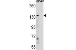 Western blot analysis of JMJD3 antibody and HeLa lysate (Kdm6b antibody  (AA 954-987))