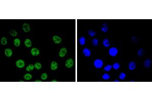 HepG2 cells were stained with Cyclin E1 (4H7) Monoclonal Antibody  at [1:200] incubated overnight at 4C, followed by secondary antibody incubation, DAPI staining of the nuclei and detection. (Cyclin E1 antibody)