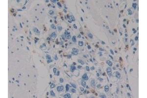 Immunohistochemistry (IHC) image for anti-Hypoxia Inducible Factor 1, alpha Subunit Inhibitor (HIF1AN) (AA 31-349) antibody (ABIN7441979)