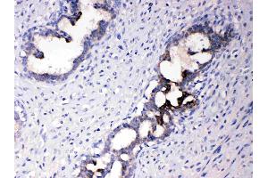 IHC analysis of ATF6 using anti- ATF6 antibody . (ATF6 antibody  (C-Term))