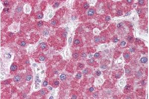 Immunohistochemistry (IHC) image for anti-ATP-Binding Cassette, Sub-Family C (CFTR/MRP), Member 5 (ABCC5) (N-Term) antibody (ABIN302162)