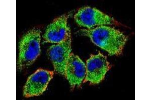 Confocal immunofluorescent analysis of A375 cells using NKD2  Antibody (C-term), followed by Alexa Fluor 488-conjugated goat anti-rabbit lgG (green). (NKD2 antibody  (C-Term))