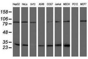 Image no. 8 for anti-NQO2 (NQO2) antibody (ABIN1499816)