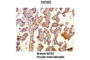 Sample Type: Human placental tissue  Primary Antibody Dilution: 1:50Secondary Antibody: Goat anti rabbit-HRP  Secondary Antibody Dilution: 1:00,000Color/Signal Descriptions: Brown: NOS2Purple: Haemotoxylin  Gene Name: NOS2 Submitted by: Dr. (NOS2 antibody  (N-Term))