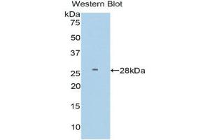 Western Blotting (WB) image for anti-Farnesyl-Diphosphate Farnesyltransferase 1 (FDFT1) (AA 187-416) antibody (ABIN3206186) (FDFT1 antibody  (AA 187-416))