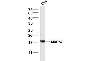 Mouse eye lysates probed with MXRA7 Polyclonal Antibody, Unconjugated  at 1:300 dilution and 4˚C overnight incubation.