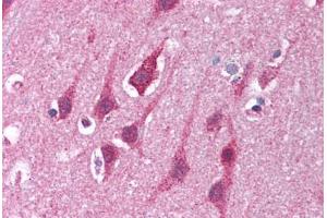 Human Brain, Cortex (formalin-fixed, paraffin-embedded) stained with MRE11A antibody ABIN214028 at 5 ug/ml followed by biotinylated goat anti-rabbit IgG secondary antibody ABIN481713, alkaline phosphatase-streptavidin and chromogen. (Mre11 antibody  (AA 68-706))