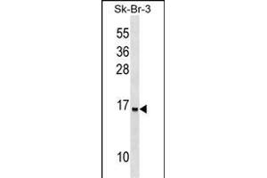 UTS2D Antibody (N-term) (ABIN1539068 and ABIN2849168) western blot analysis in SK-BR-3 cell line lysates (35 μg/lane). (Urotensin 2B antibody  (N-Term))