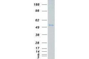 Validation with Western Blot