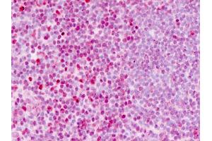 Immunohistochemistry (Paraffin-embedded Sections) (IHC (p)) image for anti-Tumor Protein P53 (TP53) (Ser315) antibody (ABIN1804357)