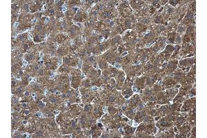 IHC-P Image Pyruvate Kinase (liver/RBC) antibody detects Pyruvate Kinase (liver/RBC) protein at cytoplasm in rat liver by immunohistochemical analysis. (Pyruvate Kinase antibody  (Center))
