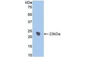 Detection of Recombinant IL1R1, Rat using Polyclonal Antibody to Interleukin 1 Receptor Type I (IL1R1) (IL1R1 antibody  (AA 386-553))