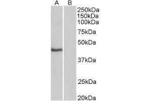 Image no. 1 for anti-TATA Box Binding Protein (TBP) (AA 2-12) antibody (ABIN1104605) (TBP antibody  (AA 2-12))