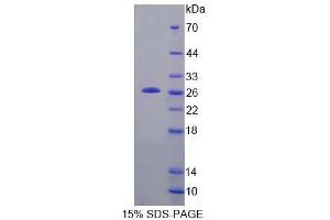 SDS-PAGE analysis of Mouse TPT1 Protein. (TPT1 Protein)