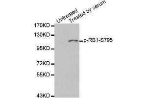Western blot analysis of extracts of 293 cell line, using phospho-RB-S795 antibody (ABIN5969932). (Retinoblastoma 1 antibody  (pSer795))
