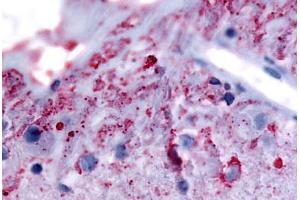 Human Eye, Ganglion Cells (formalin-fixed, paraffin-embedded) stained with GRM6 antibody ABIN213492 at 5. (Metabotropic Glutamate Receptor 6 antibody  (N-Term))