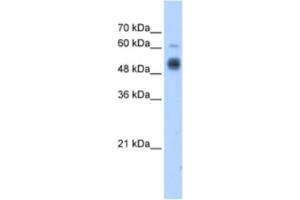 Western Blotting (WB) image for anti-Glucosaminyl (N-Acetyl) Transferase 3, Mucin Type (GCNT3) antibody (ABIN2462707) (GCNT3 antibody)