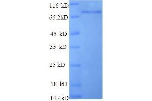 Tumor Protein P53 (TP53) (AA 2-393), (partial) protein (GST tag) (p53 Protein (His-SUMO Tag))