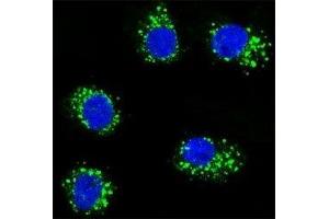 Confocal immunofluorescent analysis of MUSK antibody with MDA-MB231 cells followed by Alexa Fluor 488-conjugated goat anti-rabbit lgG (green). (MUSK antibody)