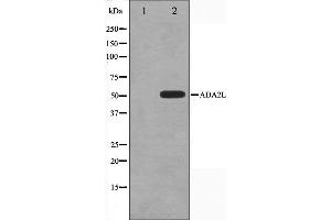 Western blot analysis on COLO205 cell lysate using ADA2L Antibody,The lane on the left is treated with the antigen-specific peptide. (TADA2L antibody)