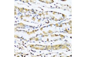 Immunohistochemistry of paraffin-embedded human stomach using GNRH1 antibody (ABIN5973277) at dilution of 1/100 (40x lens).