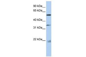 DPYSL2 antibody used at 1 ug/ml to detect target protein. (DPYSL2 antibody  (Middle Region))