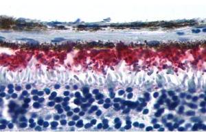 Anti-RHO / Rhodopsin antibody  ABIN1049292 IHC staining of human eye, retina. (Rhodopsin antibody  (Extracellular Domain))